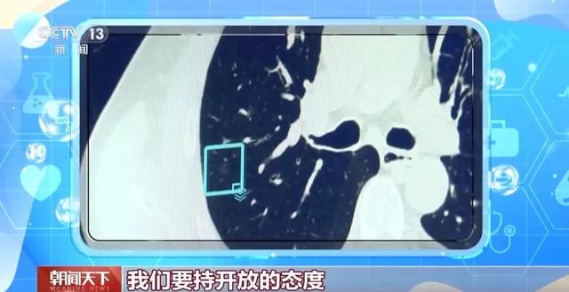 “AI醫(yī)生”能取代醫(yī)生嗎？他們這樣說